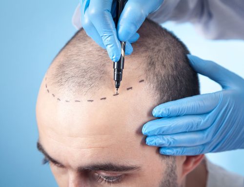 Ethical Considerations in Hair Transplantation: Navigating Patient Care Responsibly